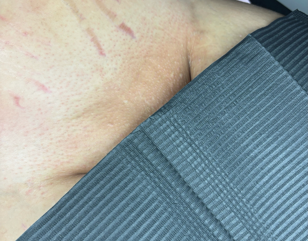 Maintenance Brazilian