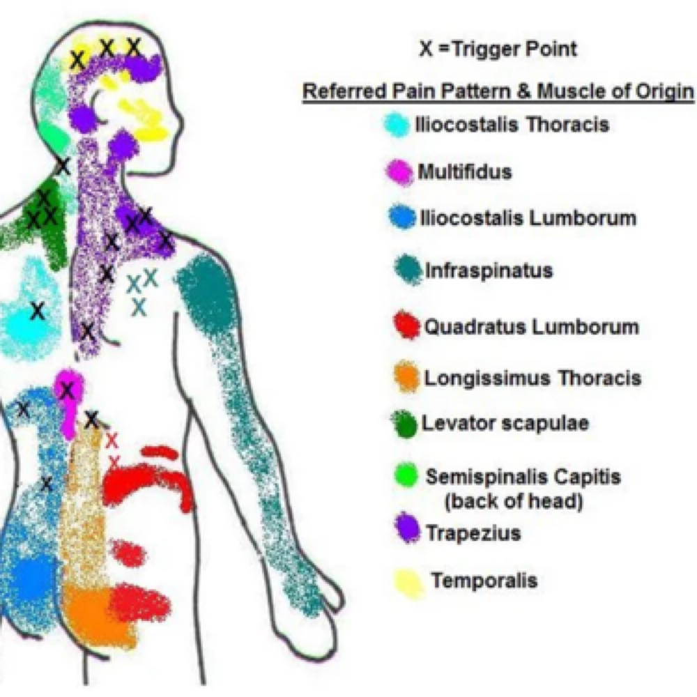 Trigger Point Therapy at Competitive Edge Massage and Wellness in Auburndale, FL