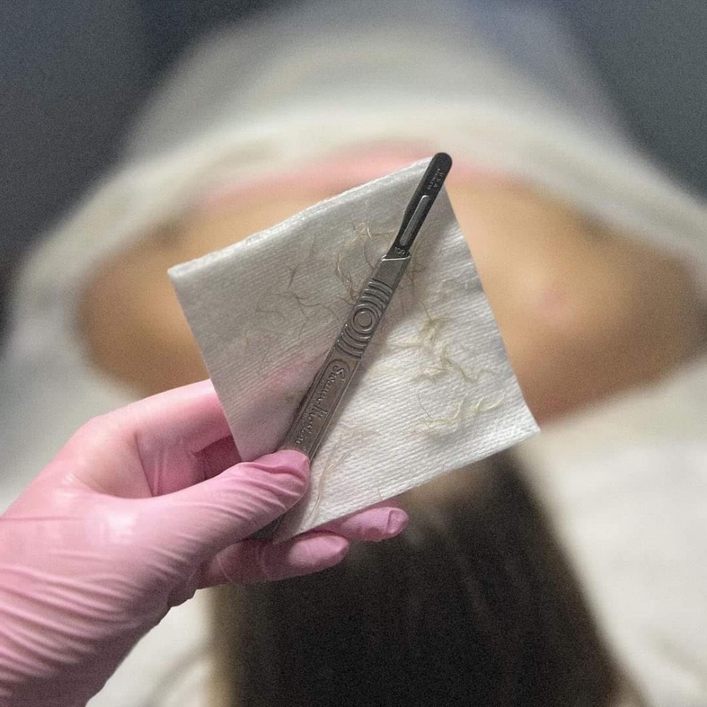Dermaplaning Add-on