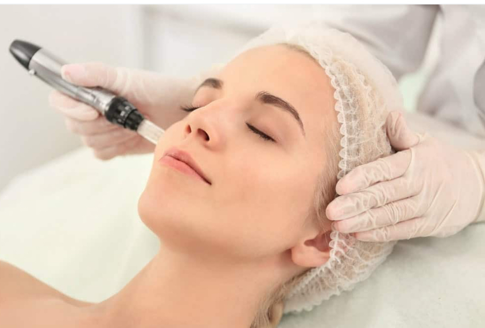 Microneedling