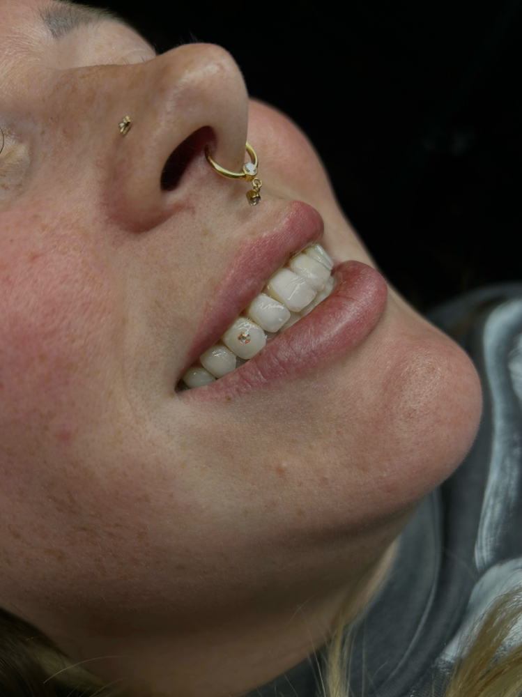 Tooth Gem