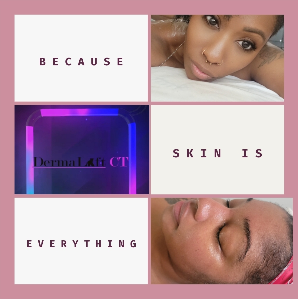 Facial With Powerderm Peel