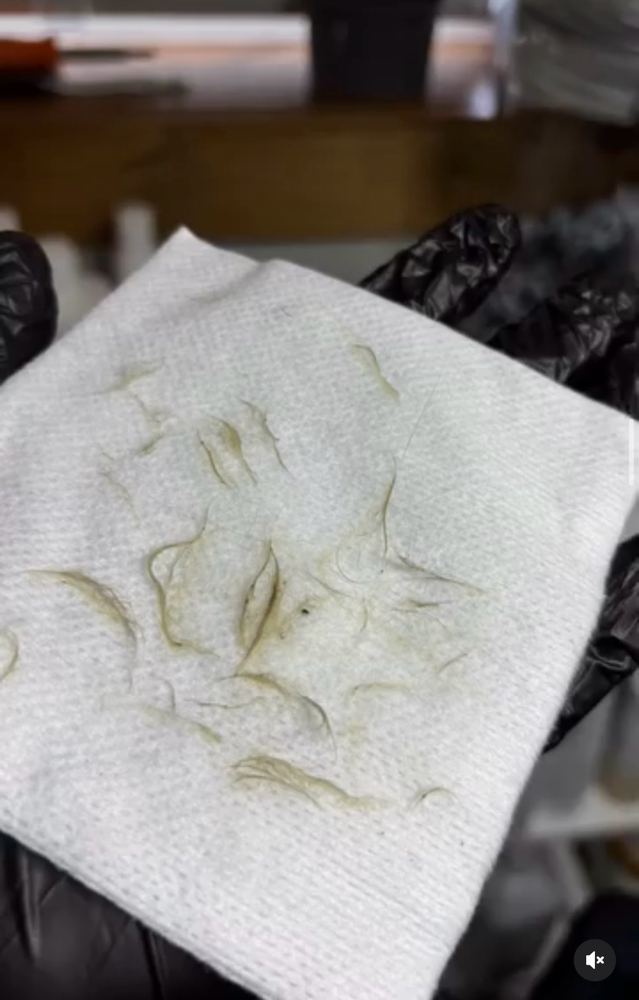 Dermaplan at Shelby  Harnish in Cochecton, NY