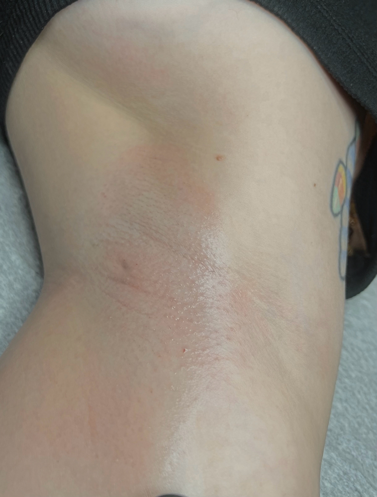 Underarm Wax