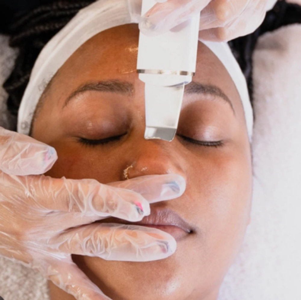 Add On Extraction at Skinsational Beauty Boutique in Bethany, OK