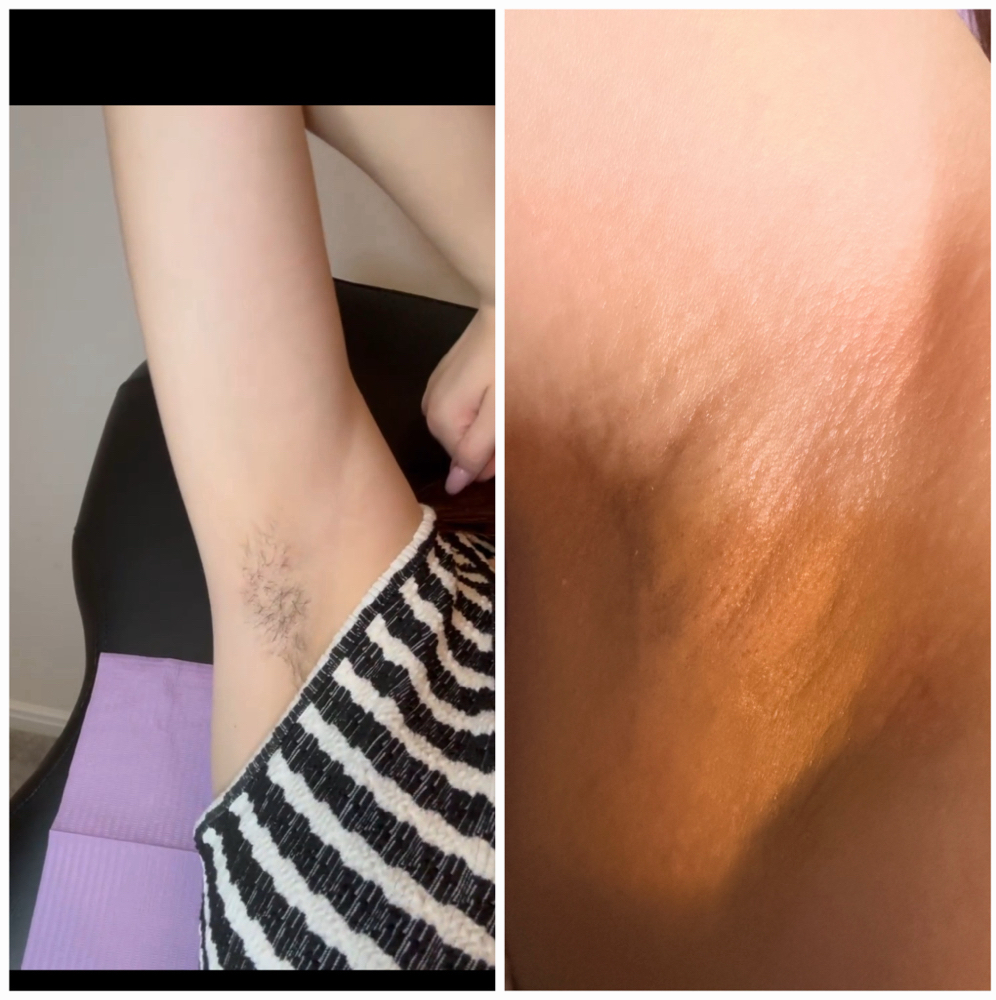 Underarm Wax at Beauxfemmesesthetics in Conroe, TX