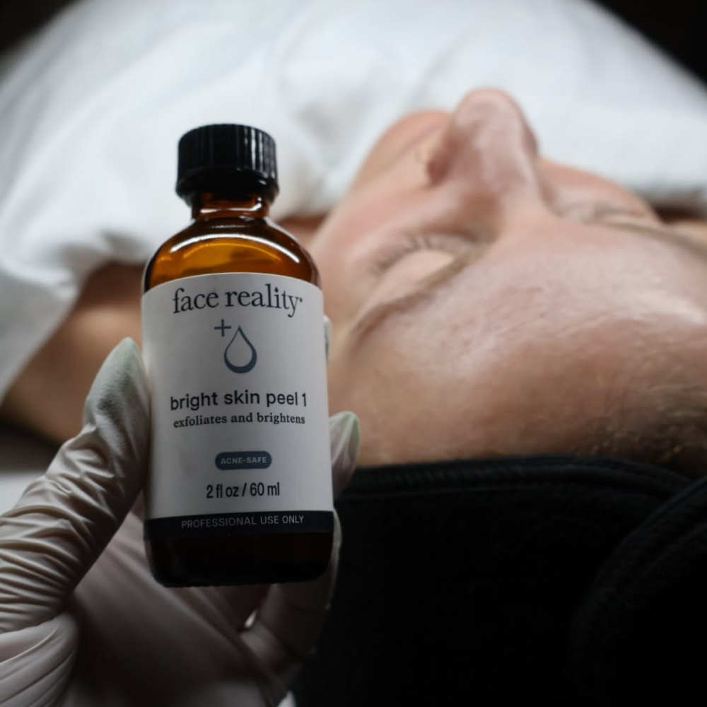 Acne Bootcamp Treatment at Skin Blvd in Macomb, MI