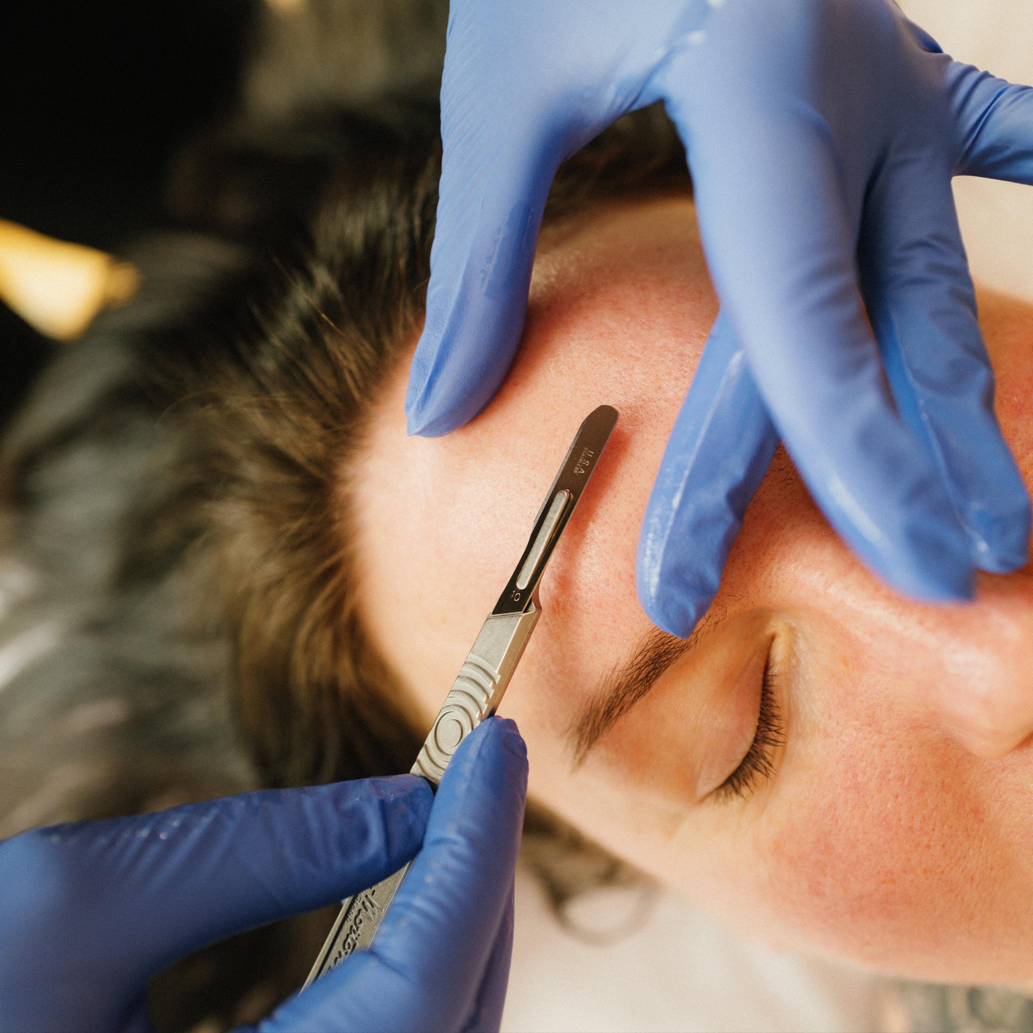 The Derm + Peel at Studio Nudi in Grand Rapids, MI