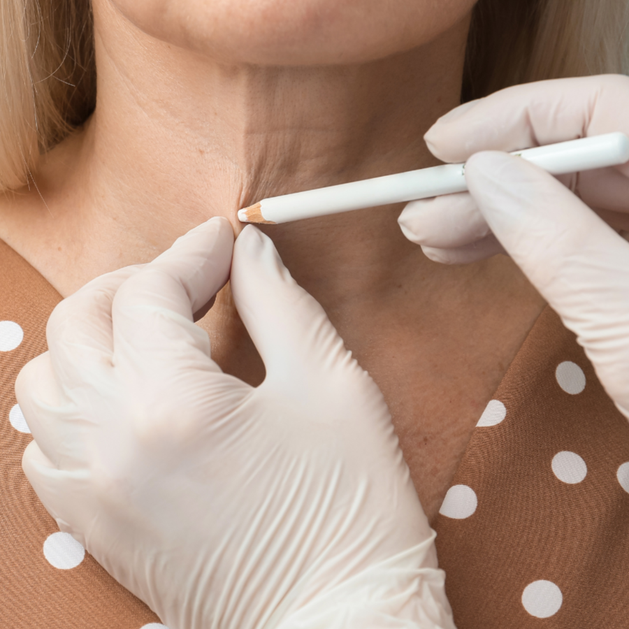 Mild To Moderate Neck Renewal at Empower Aesthetics in Canyon Lake, TX