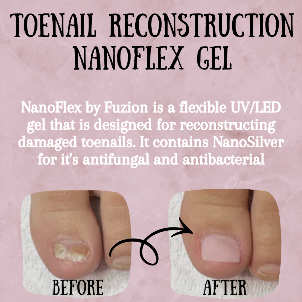 Toenail Reconstruction- NanoFlex at SheaLee Korell: CMP® & Nail Technician in Miles City, MT