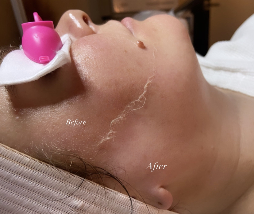 Deep Exfoliating Facial