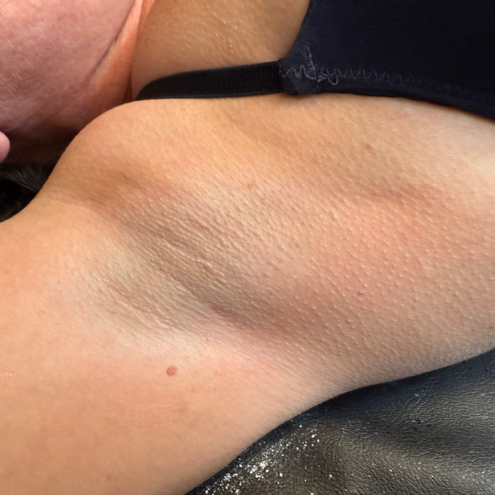 Underarm Wax at Majestic Esthetics in Vacaville, CA