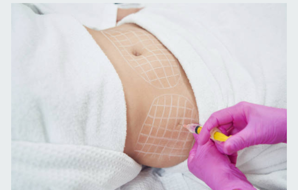 Liquid Lipo Abdomen
