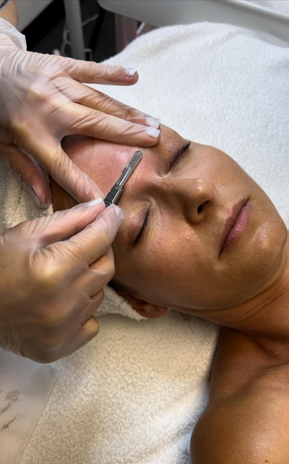 GLOW DERMAPLANE FACIAL