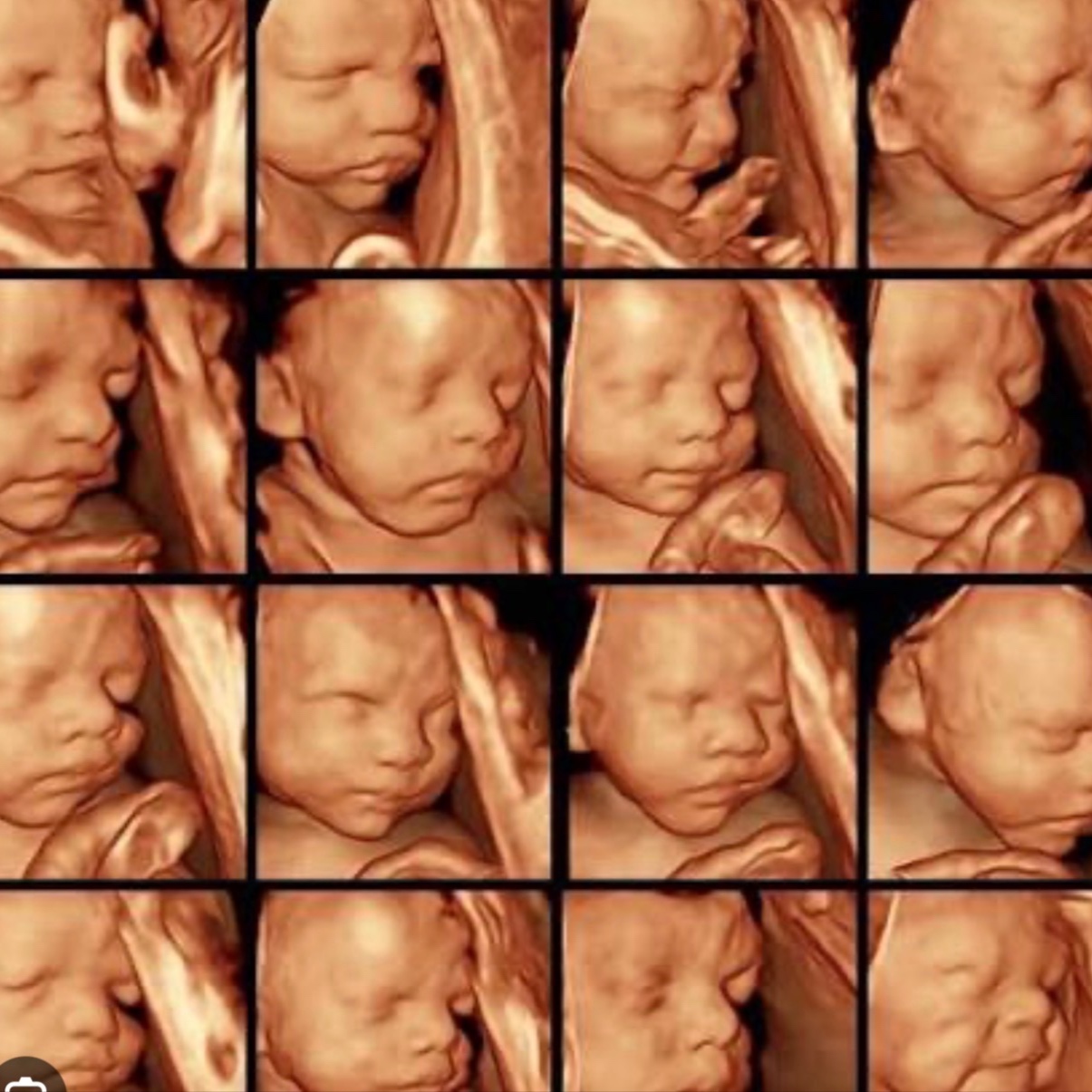 3D/4D/HD Live Scan (20-39 weeks) at Bump Studio  LLC in Rome, GA