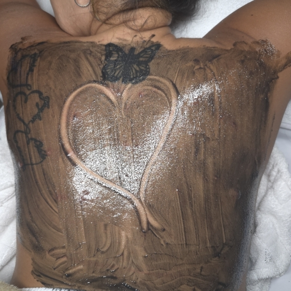 A1 Back Chemical Peel (not for new clients) at Stephs A1 Beauty Bar in Southwest Ranches, FL