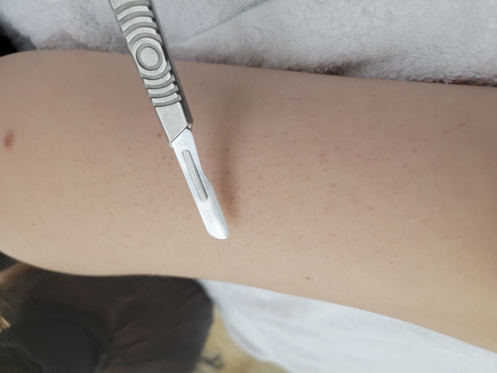 Dermaplaning
