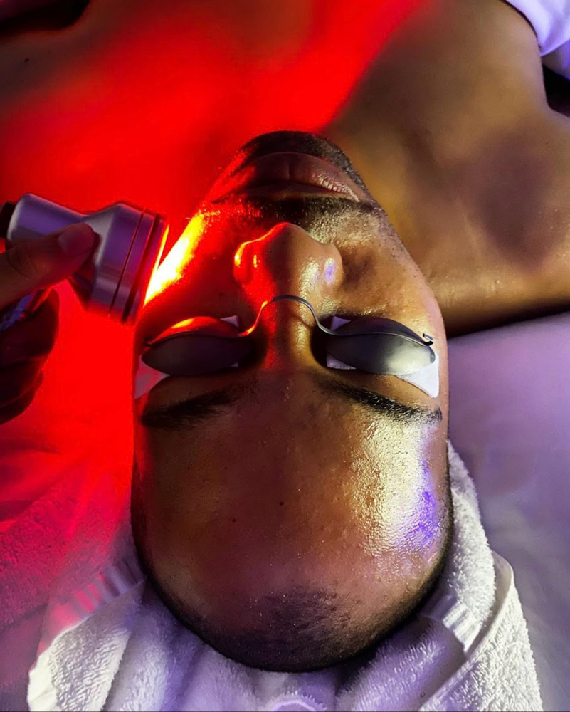 RF Therapy Face Sculpting