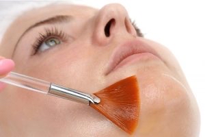 Smart Microdermabrasion Facials