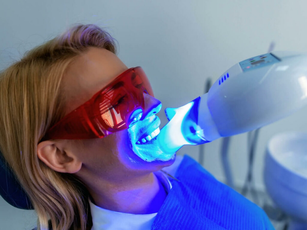 Teeth Whitening