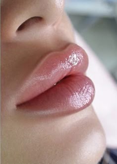 Lip Filler at VieHava Beauty in Maricopa, AZ