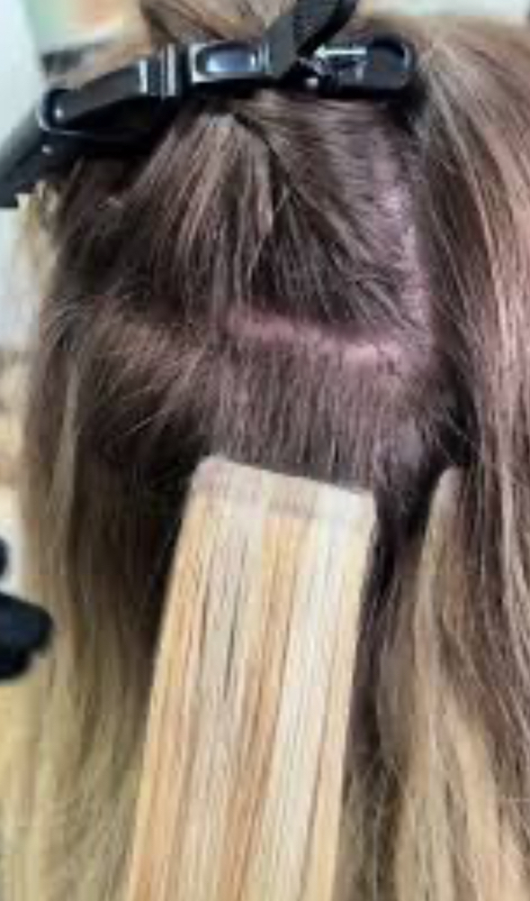 Removal of extensions
