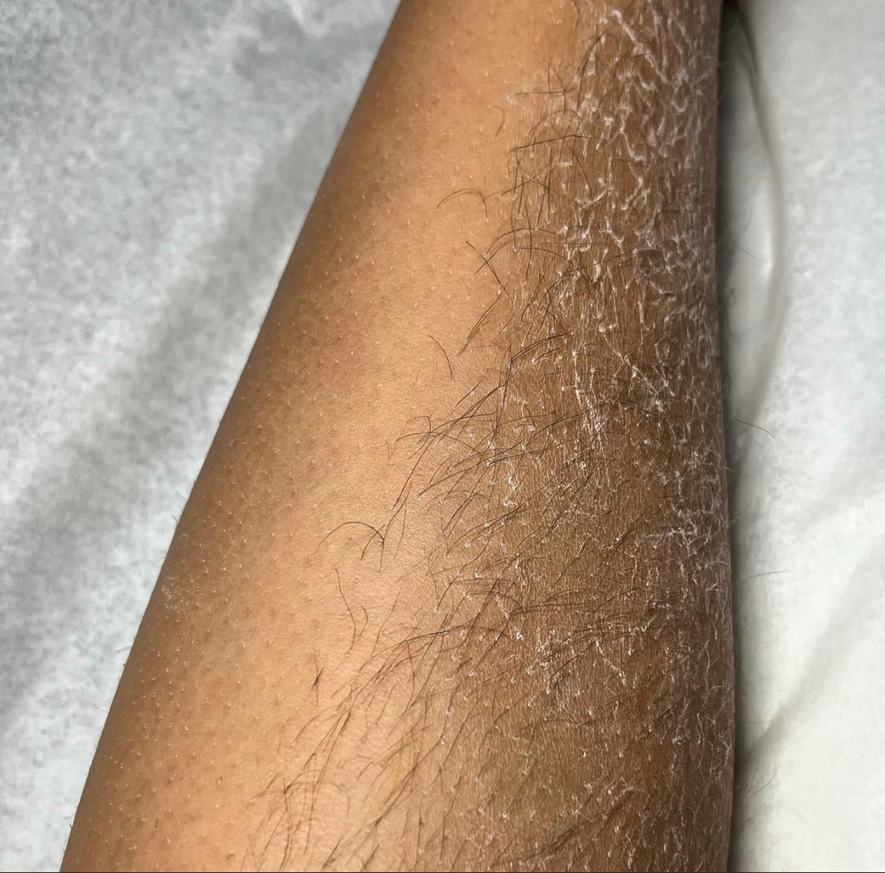 Leg Wax 1/2