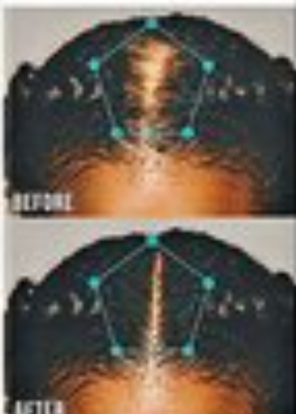 Spray Color ( for Thin, Balding )