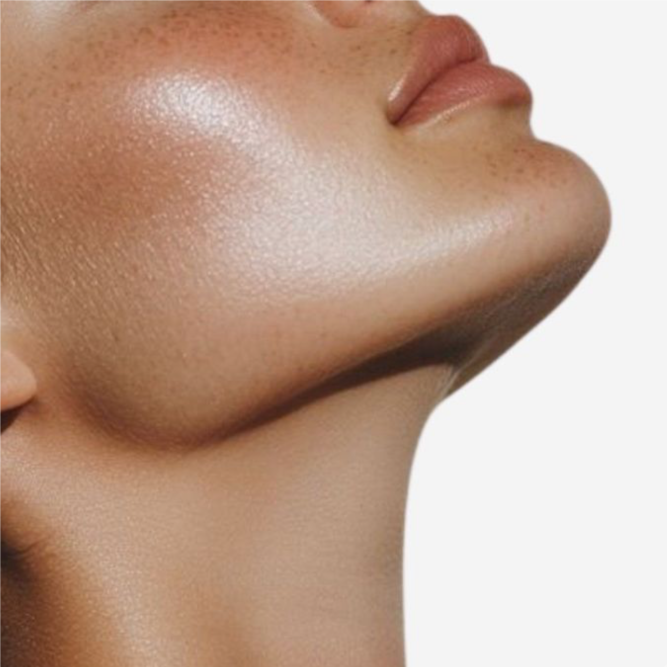 Exceed Microneedling Face & Neck at The Laser Vault in Phoenix, AZ