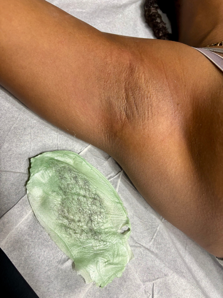 Underarms at Tranquil Touch Esthetics LLC in Washington, DC