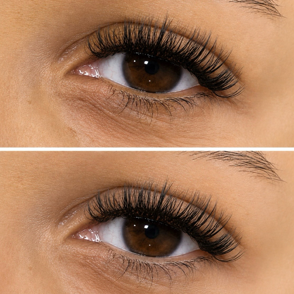 Classic Fill at Allure Aesthetics by Emily in Hilton Head Island, SC
