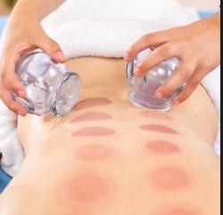 Cupping Add On