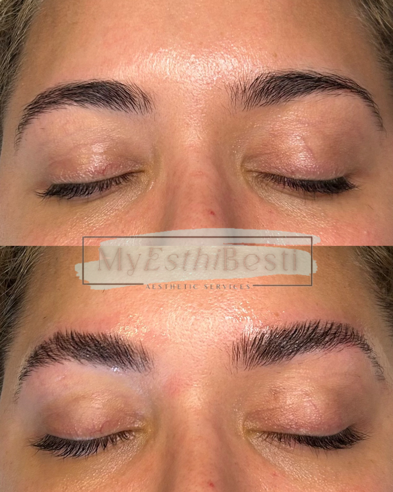 Brow Lamination