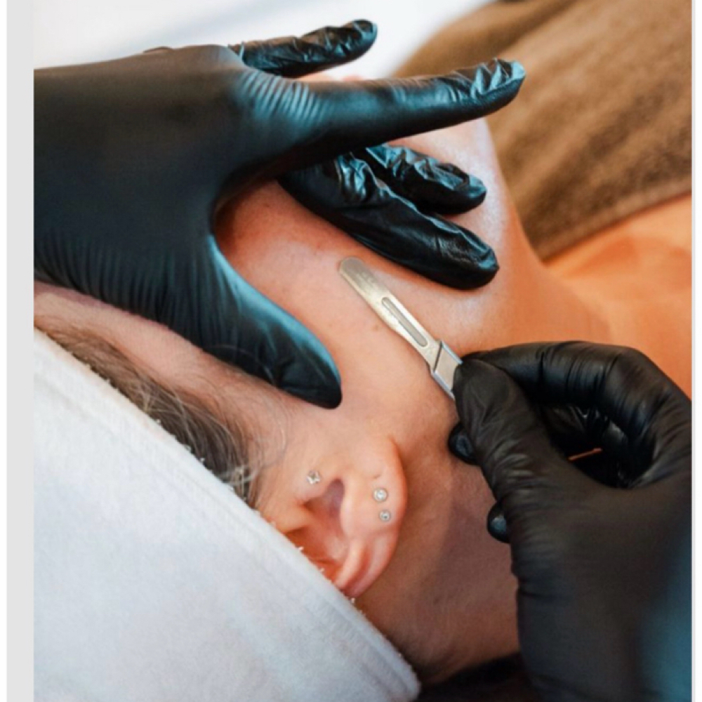 Dermaplaning Facial at Harmony Skin & Laser in Ashland, OR