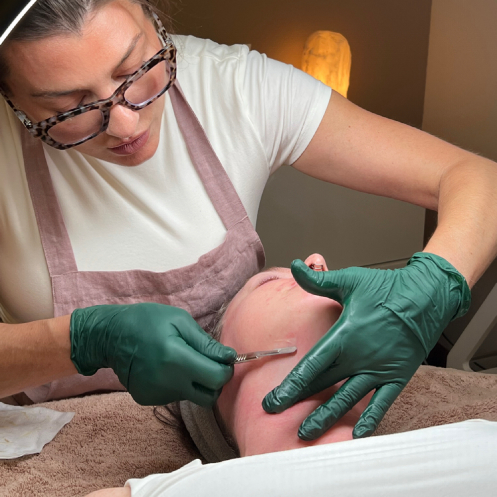 Dermaplaning Facial at Harmony Skin & Laser in Ashland, OR