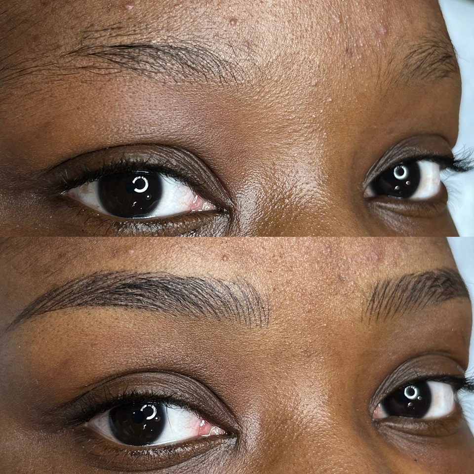 Nano HairStroke $750