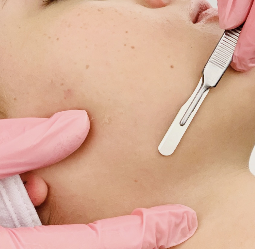 Dermaplane Facial Ad-on