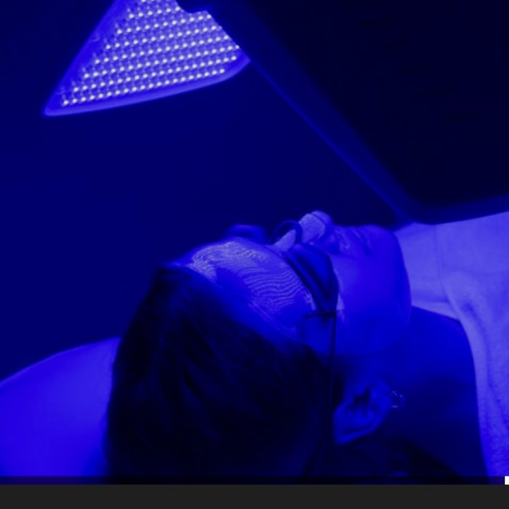 chemical peel/acne/blue light at Nina Beauty&Brows Studio in North Hollywood, CA