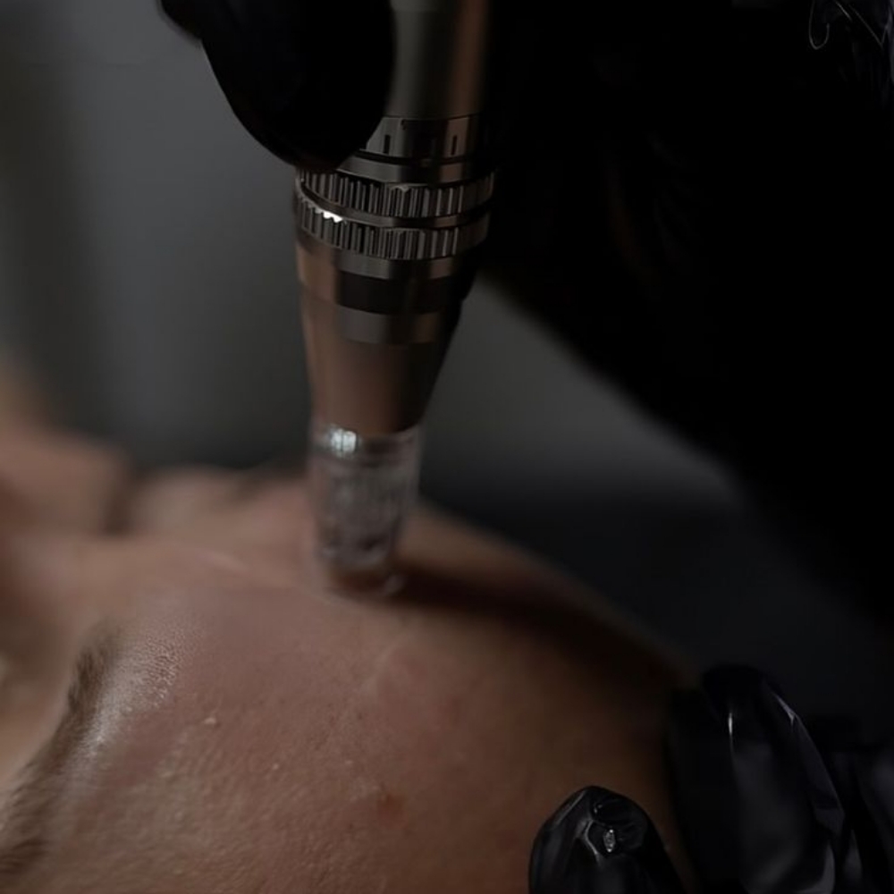 Nano Infusion Therapy at Xiomara Studio in Dallas, TX