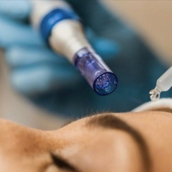 Microneedling at DePianoSkin in west hollywood, CA