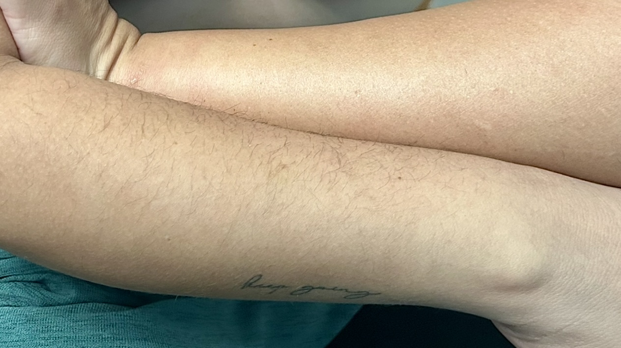 Half Arms, Legs