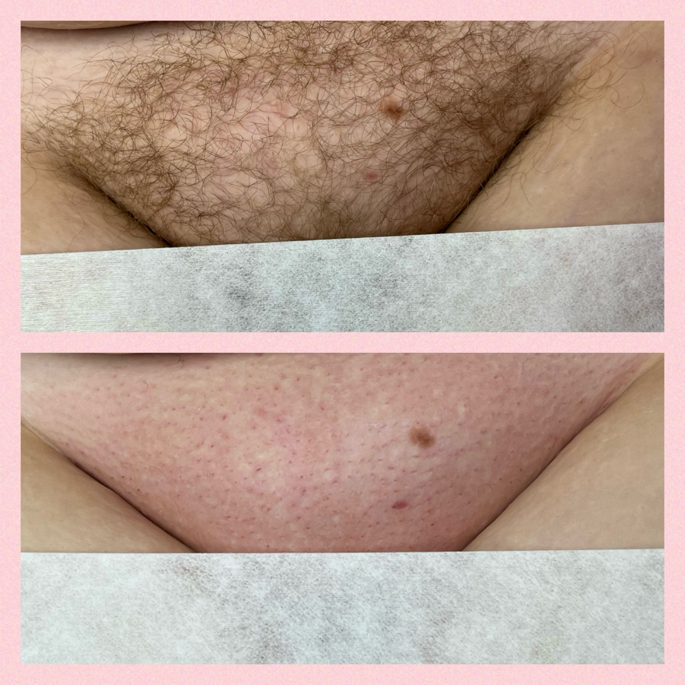 Brazillian Wax at Alexis Kirby in Dayton, OH