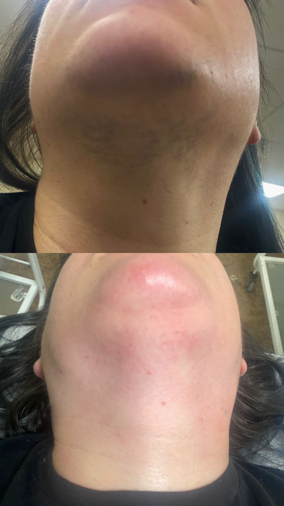 Facial Wax