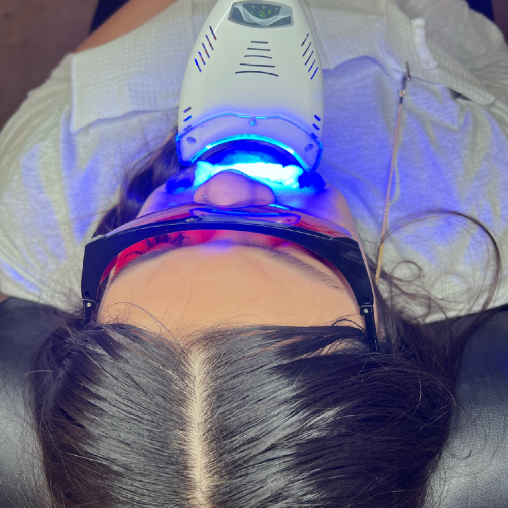 Teeth Whitening Touch up at Blessed Beauty Aesthetics, LLC in Houston, TX