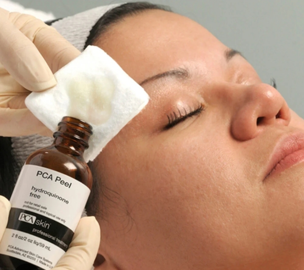 PCASKIN Chemical Peel/ Microdermabr