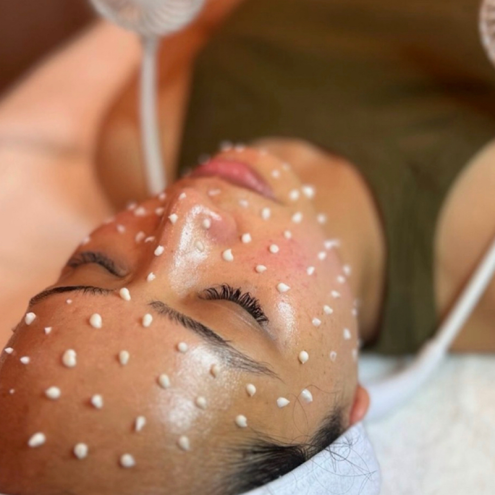 LIQUID MICRONEEDLING & RED LIGHT at SWEETFACE in Boca Raton, FL
