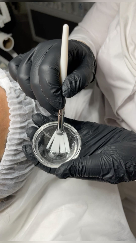 The Corrective Peel