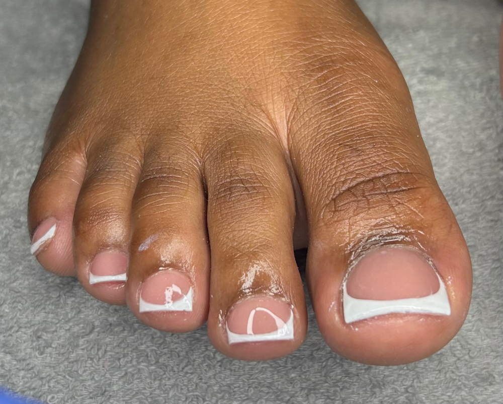 Acrylic Toe(s)