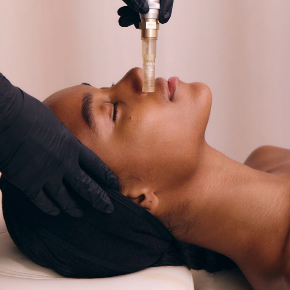 Nano-Needling Face/Neck/Deck at SKINJEVITY BY DARA in Castle Rock, CO