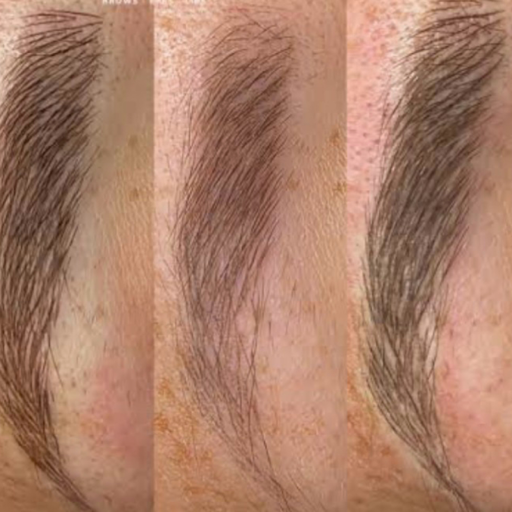 Permanent makeup touchup at Rewind Med Spa in Longmont, CO